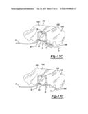 Apparatus For Coupling Soft Tissue To A Bone diagram and image