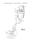 Apparatus For Coupling Soft Tissue To A Bone diagram and image