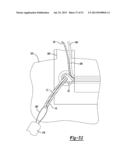 Apparatus For Coupling Soft Tissue To A Bone diagram and image