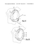 Apparatus For Coupling Soft Tissue To A Bone diagram and image