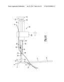 Apparatus For Coupling Soft Tissue To A Bone diagram and image