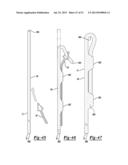 Apparatus For Coupling Soft Tissue To A Bone diagram and image