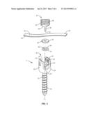 VERTEBRAL FASTENER SYSTEM diagram and image