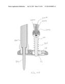 Bone Anchor Assembly, Bone Plate System, And Method diagram and image