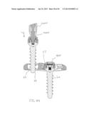 Bone Anchor Assembly, Bone Plate System, And Method diagram and image