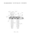 Bone Anchor Assembly, Bone Plate System, And Method diagram and image