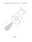 System and Method for Bone Fixation diagram and image