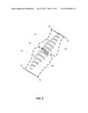 System and Method for Bone Fixation diagram and image