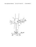 EMBOLIC PROTECTION SYSTEMS FOR BIFURCATED CONDUITS diagram and image