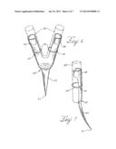 BARBED ANCHORS FOR WIRE STENT diagram and image