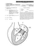 Prosthetic Valve for Replacing Mitral Valve diagram and image