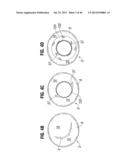 Prosthetic Valve for Replacing Mitral Valve diagram and image