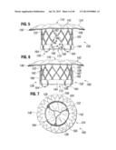 Prosthetic Valve for Replacing Mitral Valve diagram and image