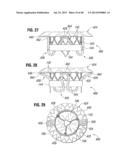 Prosthetic Valve for Replacing Mitral Valve diagram and image