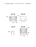 Prosthetic Valve for Replacing Mitral Valve diagram and image