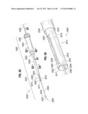 Prosthetic Valve for Replacing Mitral Valve diagram and image