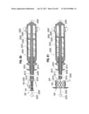 Prosthetic Valve for Replacing Mitral Valve diagram and image