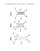 Prosthetic Valve for Replacing Mitral Valve diagram and image