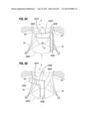 Prosthetic Valve for Replacing Mitral Valve diagram and image