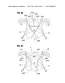 Prosthetic Valve for Replacing Mitral Valve diagram and image