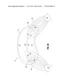 Prosthetic Valve for Replacing Mitral Valve diagram and image