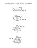 SHEATHS FOR EXTRA-ARTICULAR IMPLANTABLE SYSTEMS diagram and image