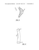 SHEATHS FOR EXTRA-ARTICULAR IMPLANTABLE SYSTEMS diagram and image