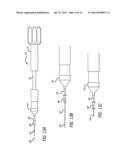 SHEATHS FOR EXTRA-ARTICULAR IMPLANTABLE SYSTEMS diagram and image