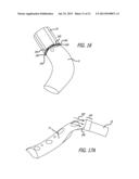 SHEATHS FOR EXTRA-ARTICULAR IMPLANTABLE SYSTEMS diagram and image