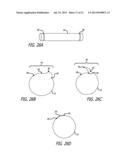 SHEATHS FOR EXTRA-ARTICULAR IMPLANTABLE SYSTEMS diagram and image