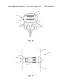 EXPANDABLE INTERBODY IMPLANT AND METHODS OF USE diagram and image