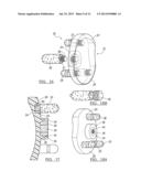 MODULAR CENTER PEGGED GLENOID diagram and image