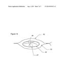 DISPOSABLE OPHTHALMIC/MEDICAL APPARATUS WITH TIMED COLOR CHANGE INDICATION diagram and image