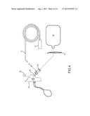 Reservoir System for Gas Delivery to a Patient diagram and image