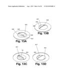 Rupture disk and hinge diagram and image