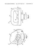 REMOVABLE SAFETY CHAIN TIE DOWN APPARATUS diagram and image