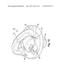 REMOVABLE SAFETY CHAIN TIE DOWN APPARATUS diagram and image