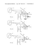 MULTI-CAMERA VISION SYSTEM FOR A VEHICLE diagram and image