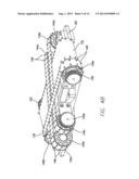 WATCH ASSEMBLY HAVING A PLURALITY OF TIME-COORDINATED BELTS diagram and image