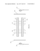 EAR WARMER diagram and image