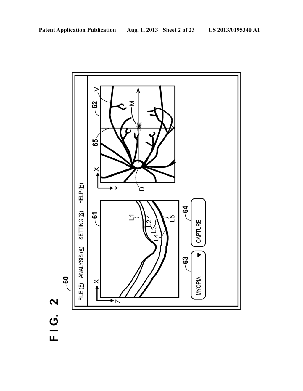 IMAGE PROCESSING SYSTEM, PROCESSING METHOD, AND STORAGE MEDIUM - diagram, schematic, and image 03