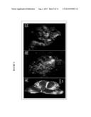 METHOD FOR LABELING INSULIN-SECRETING PANCREATIC BETA CELLS AND OBTAINING     PURIFIED INSULIN-SECRETING PANCREATIC B-CELLS AND AN INSULIN REPORTED diagram and image