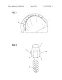 DEVICE TO BE COUPLED TO A DENTAL IMPLANT ABUTMENT, PROVIDED WITH AT LEAST     ONE CONNECTING ELEMENT diagram and image