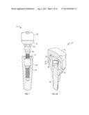 Healing Abutment Assembly With Combination Of Scanning Features diagram and image