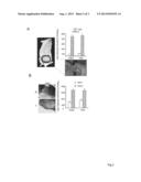 Method and a kit to quantify and qualify exosomes for diagnosis of     prostate cancer and prostate hyperplasia diagram and image