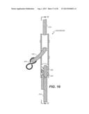 VEHICLE MOUNTED MULTI-POSITION RESISTANCE TUBE EXERCISE APPARATUS diagram and image