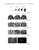 N-ACETYL MANNOSAMINE AS A THERAPEUTIC AGENT diagram and image