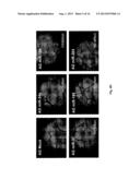 MICRORNA PATTERNS FOR THE DIAGNOSIS, PROGNOSIS AND TREATMENT OF MELANOMA diagram and image