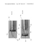 Unitary Endoscopic Vessel Harvesting Devices diagram and image