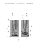 Unitary Endoscopic Vessel Harvesting Devices diagram and image